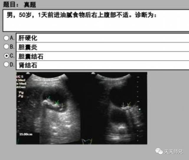 执业医师第三站真题(上篇)