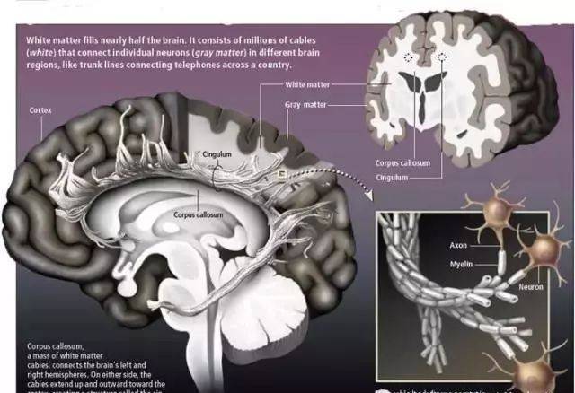 什么是脑白质