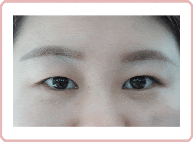 内双的雪梨, 为什么用了两款纤维形的双眼皮贴, 都完全不能将内双变外