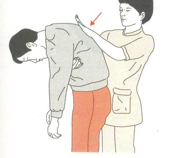 背部叩击法 适用于意识清楚,有严重气道异物梗阻症状的患者.