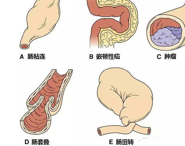出现扁条,细条,有压痕,羊粪状等异常的形状,这是要引起重视,临床上