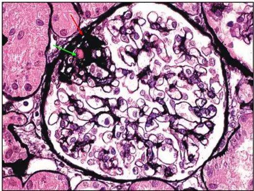 原则上诊断该 图 1 肾小球的绿色:肾小球脏层上皮细胞(足细胞)或壁层