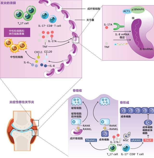 白介素17(il-17)在脊柱关节炎(spa)免疫学发病机制中的作用