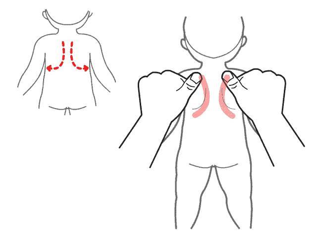 小儿推拿:小儿支气管炎治疗下篇