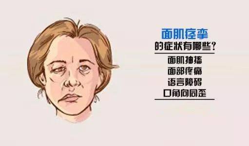 剖析面肌痉挛的中医分型有哪些阶段
