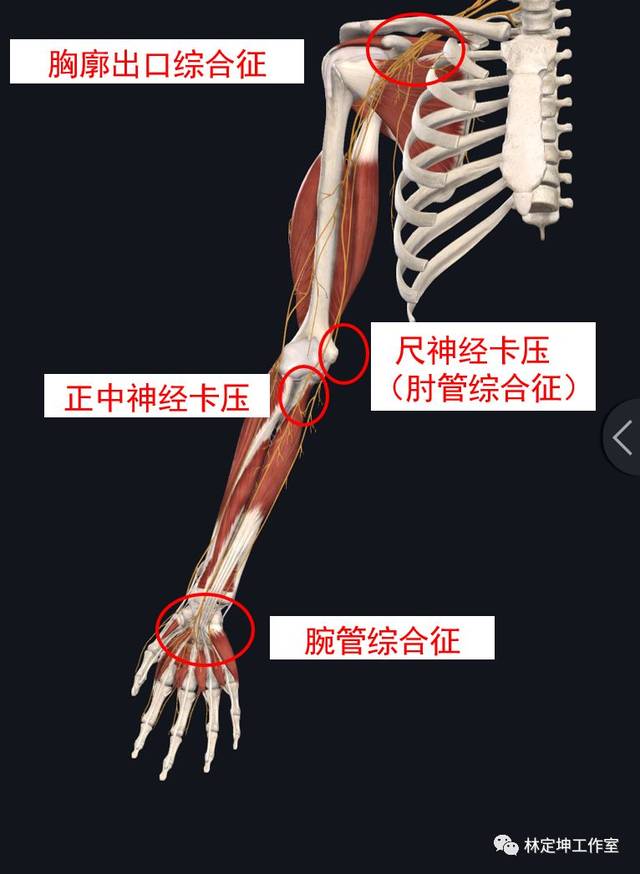 谈骨论筋手麻手痛除了可能是颈椎病还有可能是