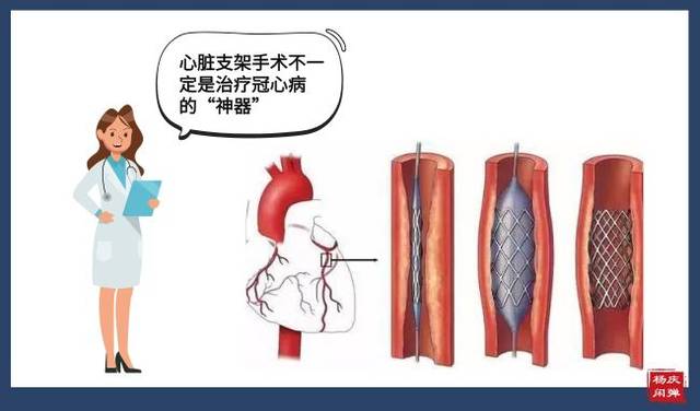 救命的心脏支架:是神话,还是谎话?