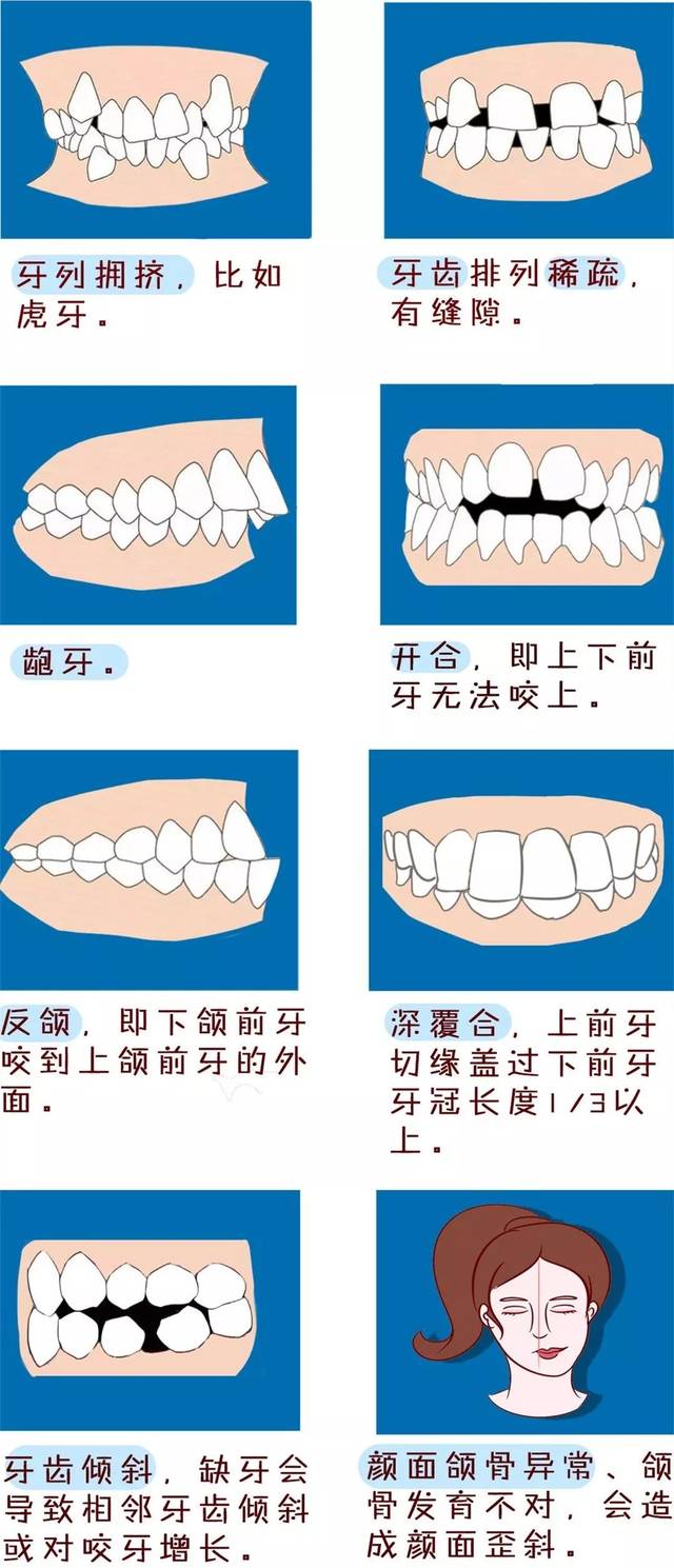 错颌畸形的原因