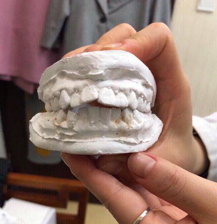 在重庆,牙齿矫正最低多少钱?可以不拔牙?成年