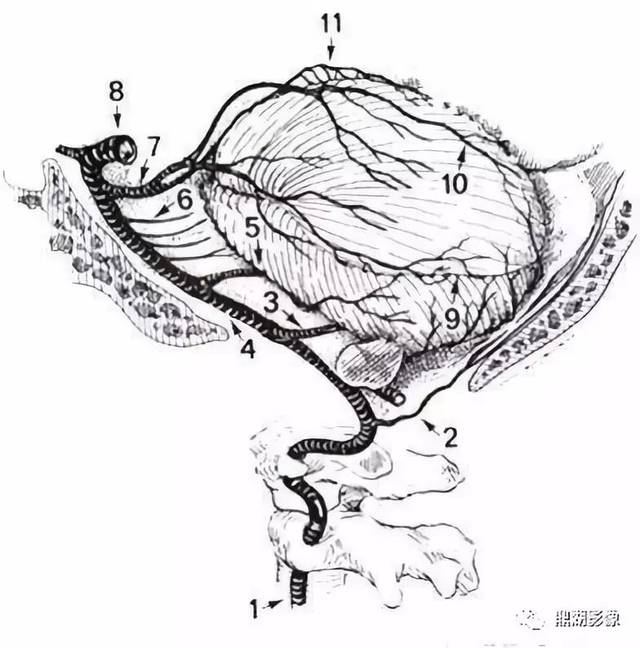 椎基底动脉系统及其分支解剖(侧位)