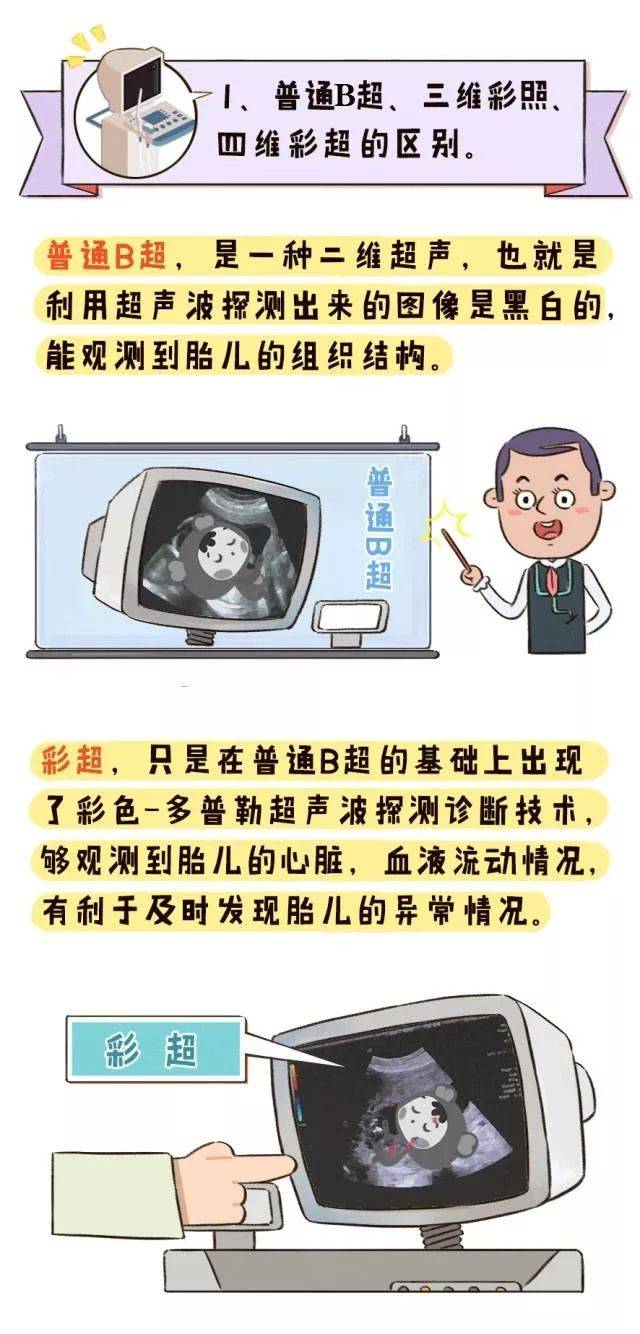 孕期检查很重要，四维彩超排畸不可少！