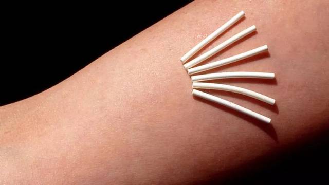 美国人避孕都用哪些方法？绝对开眼界