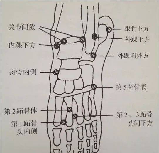 踝及足部检查----常见压痛点