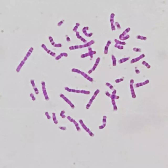 更高,更准,更美—550条带染色体核型分析