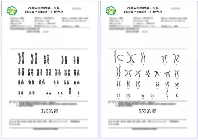 染色体数目异常包括整倍体改变即成倍的增加或减少,以及非整倍体改变