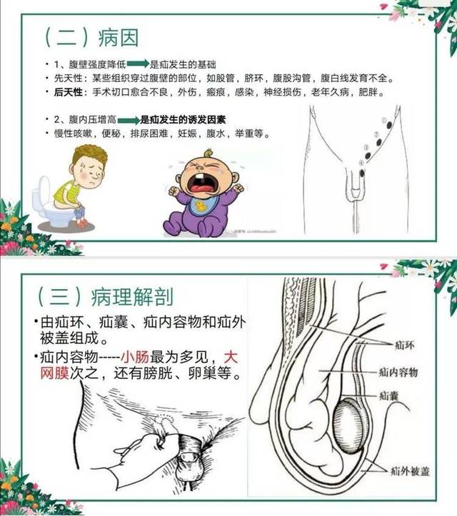 【地医-护理】外一科护理业务查房——腹外疝的围手术