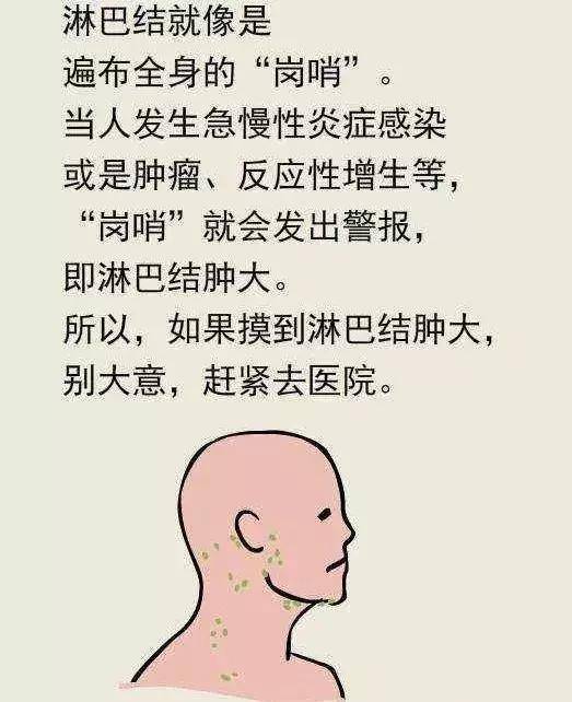 发热盗汗消瘦,淋巴结肿大,是淋巴结炎还是淋巴瘤?医生:勿轻视