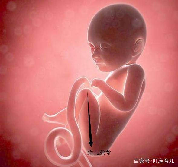 产检医生说胎儿"股骨短",是胎儿腿短的意思吗?这些意义要了解