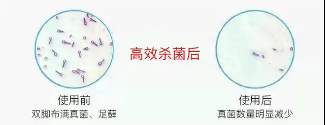脚臭,脚痒,脚脱皮?喷一喷这只天然草本精华,十年的脚气都好了!