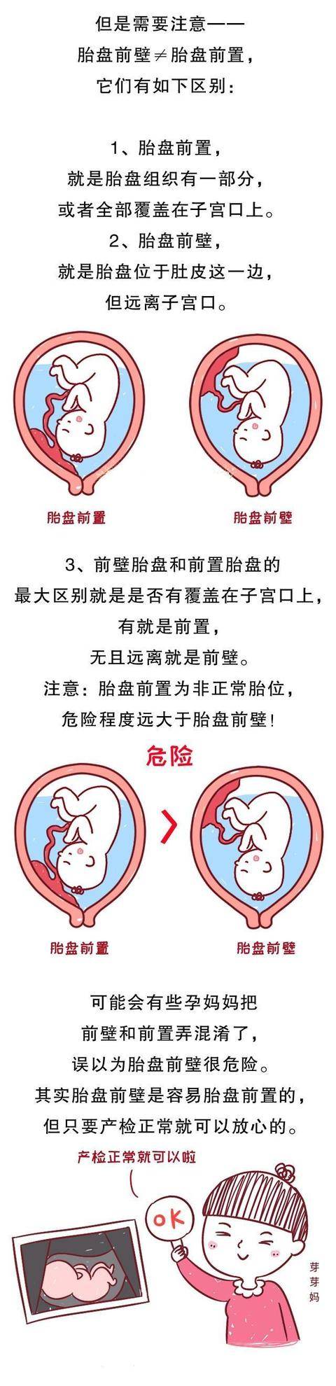 我们b超单上, 是什么意思?哪个更好生? 关于前壁和后壁那些事!