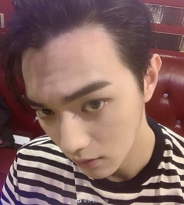 许凯晒自拍发际线堪忧,自嘲许家第一个m字头