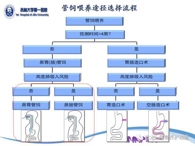 鼻肠管留置的位置如何判定?ppt全面告诉你!