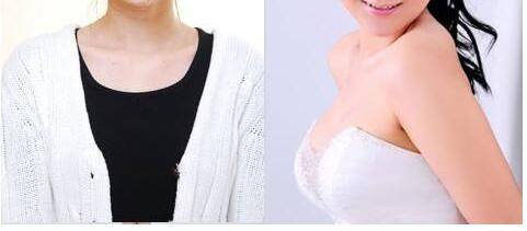 2019年南京整形医生技术口碑报告火爆一览