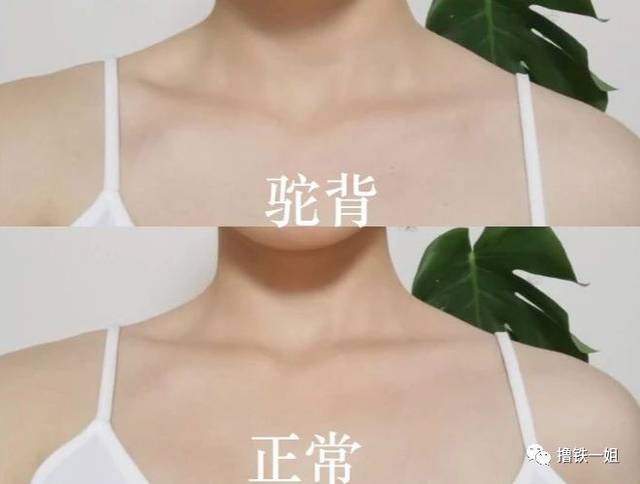 泫雅畸形锁骨?戚薇陈乔恩锁骨放鸡蛋是因为斜方肌太粗壮了!