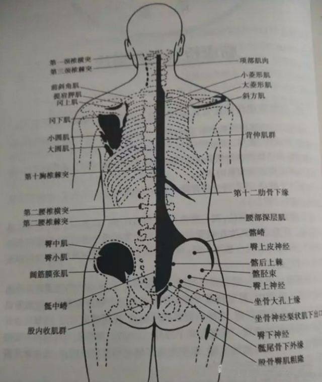 常见软组织损伤压痛点(二)