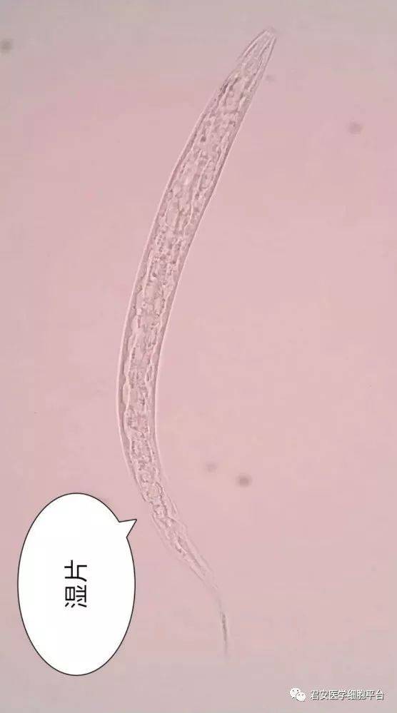 【独家报道】现场直播:钩虫宝宝破壳而出