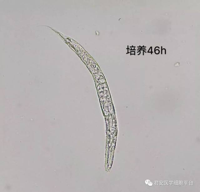 【独家报道】现场直播:钩虫宝宝破壳而出