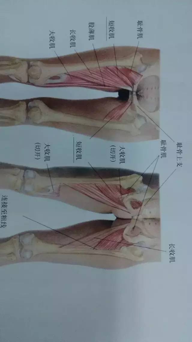上述两肌均为股神经支配,若已排除肌肉本身病变,若考虑骨神经导致时