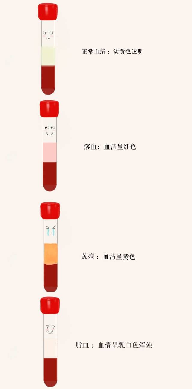 每次抽血条码打出来,贴在不同的试管上,一堆试管摆在患者面前,患者总