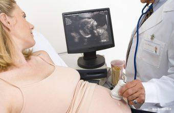 怀孕3个月,看懂B超单上这两个数据,胎儿就