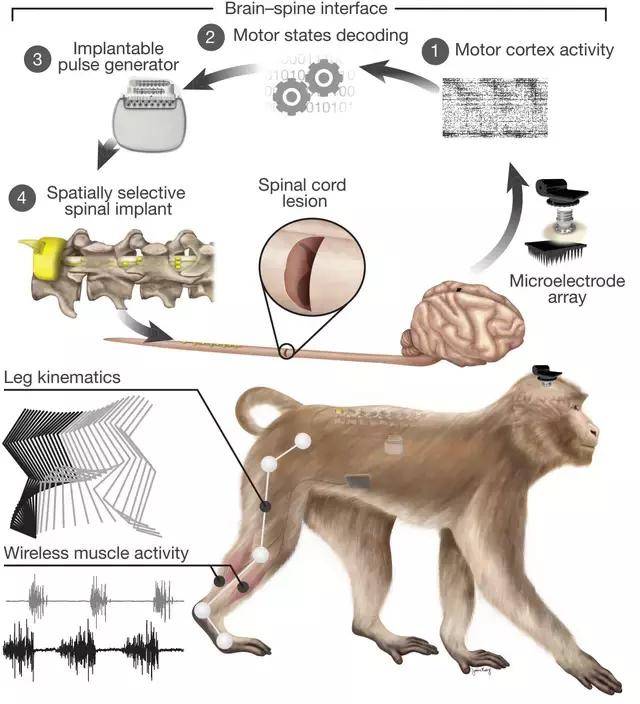 后肢瘫痪的猴子接受了一个名叫"脑-脊髓接口"的神经假体界面的治疗