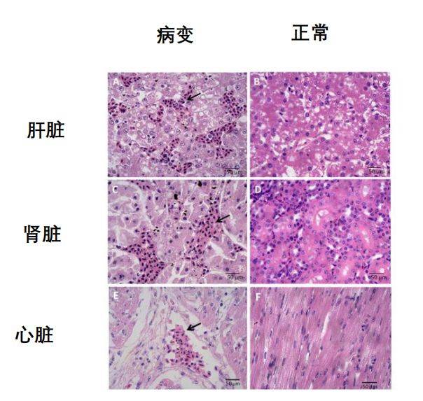 8. 病理切片显示肝脏,肾脏,心脏出血明显