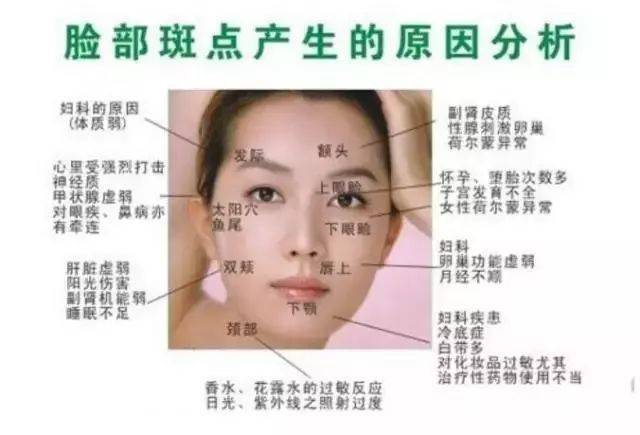 脸颊长斑:肝脏虚弱,紫外线照射,失眠现象; 嘴角周围长斑:子宫卵巢及