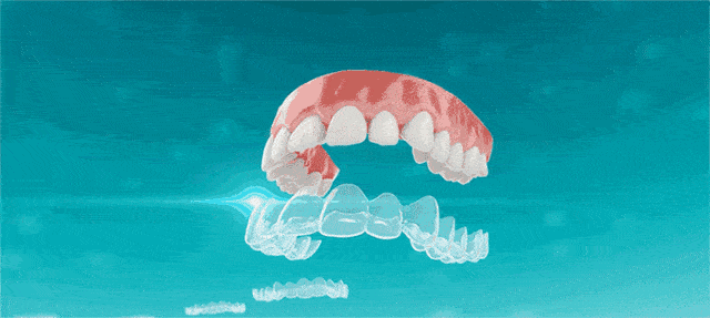 所有重庆人,即日起牙齿矫正,种植牙绝不多花一分钱!