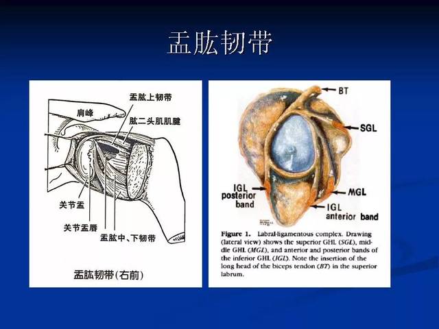 肩关节盂唇损伤的mri诊断 影像天地