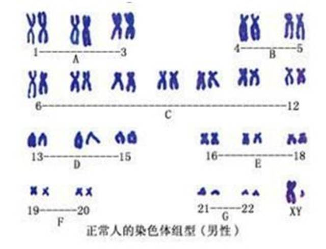 染色体核型分析重要吗?