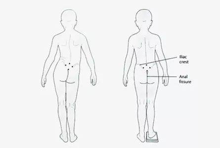 3个方法,秒治长短腿
