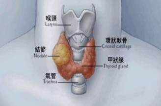 甲状腺穿刺活检是什么检查?穿刺前后,你应该了