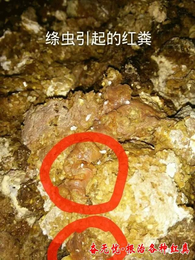 鸡拉红粪,为何难治,复发率特高?