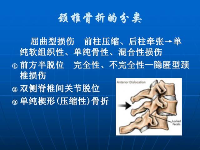 在安全带型的基础上,外加椎体间脱位或半脱位,可有单纯韧带损伤及合并