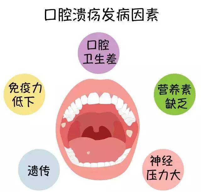 你还以为口腔溃疡是因为上火吗