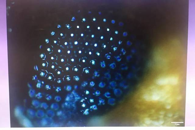 显微镜下蚂蚁的眼睛