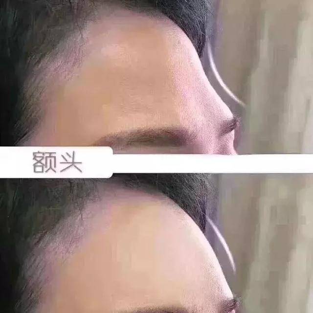 细数耐老脸的6大特征