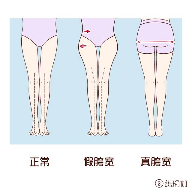 总有朋友在后台跟我抱怨自己"屁股好大,怎么办?