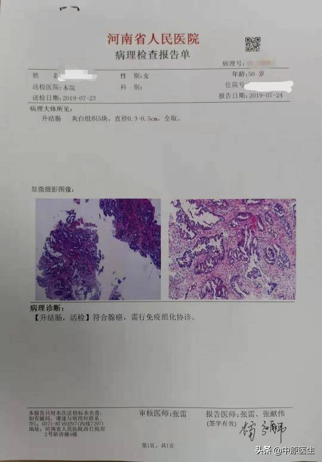 做胃息肉切除时省级专家反复劝说患者顺便做一下胃肠镜,发现腺癌