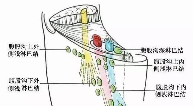 腹股沟淋巴堵塞,会直接导致腹腔内环境变差,大腿根部假性肥胖,大肠内